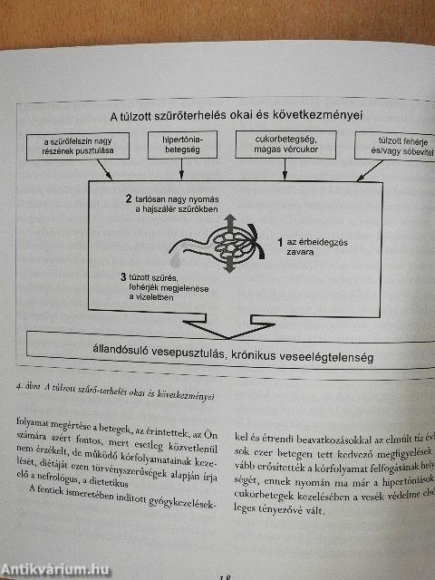 Krónikus vesebetegek étrendje és életmódja