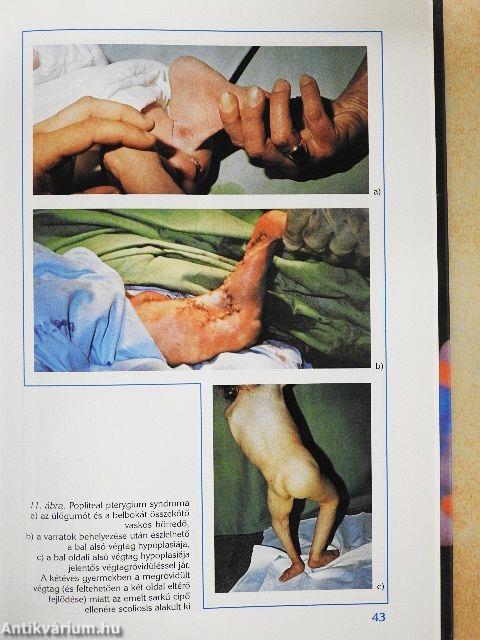 A klinikai genetika alapjai