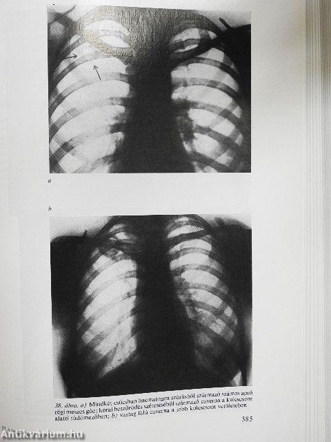 A belgyógyászat alapvonalai 1-2.