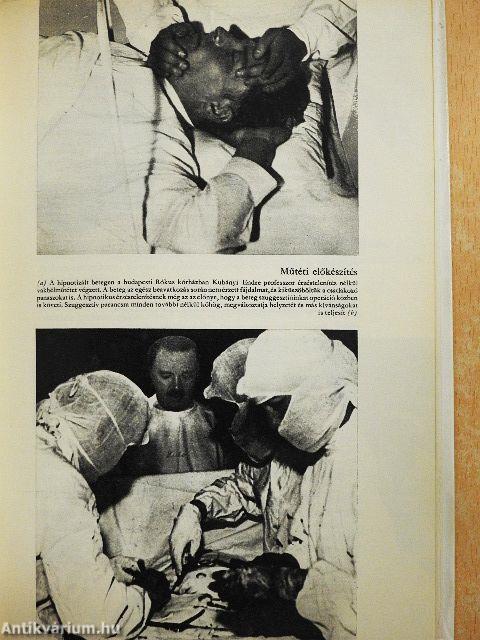 Emberek, állatok hipnózisa