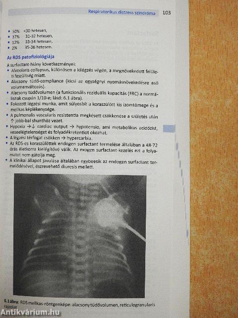 A neonatológia oxford kézikönyve