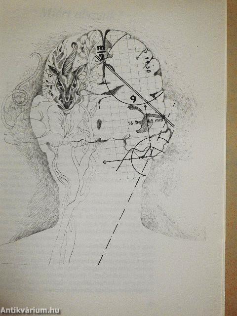 Alvás, álom, álmatlanság