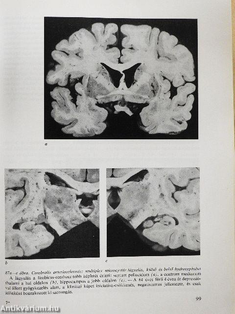 A klinikai neurologia alapjai
