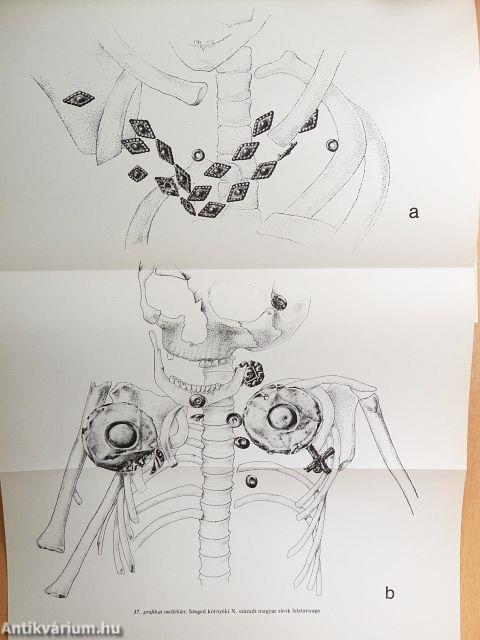 Szeged története 1-4.