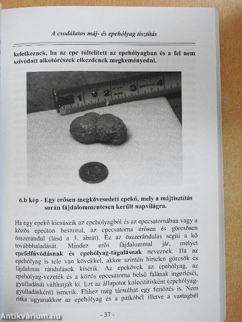 A csodálatos máj- és epehólyag tisztítás