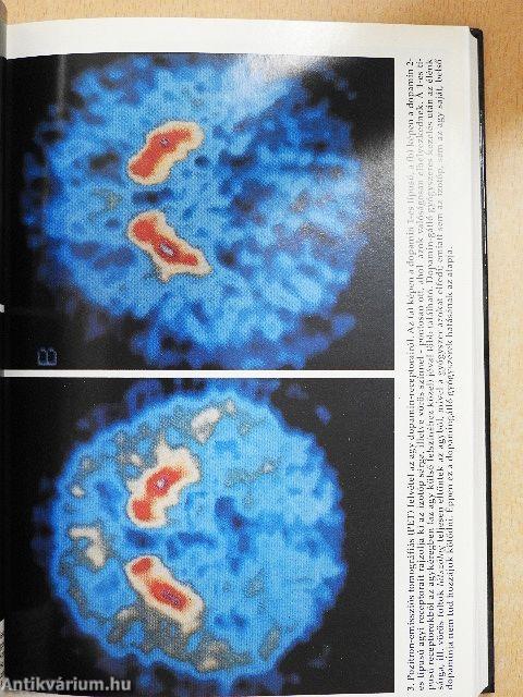 Az agy évtizedében