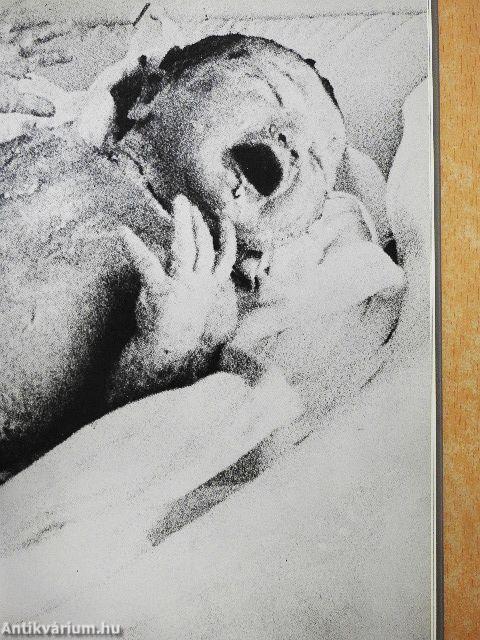 A gyöngéd születés