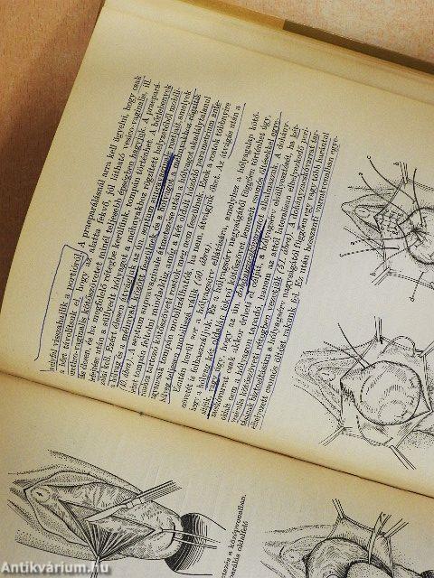 Nőgyógyászati műtéttan