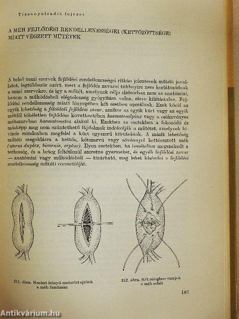 Nőgyógyászati műtéttan