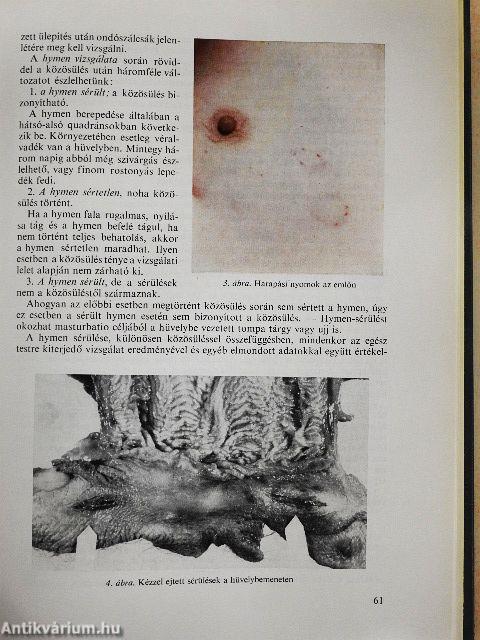 Az igazságügyi orvostan alapjai