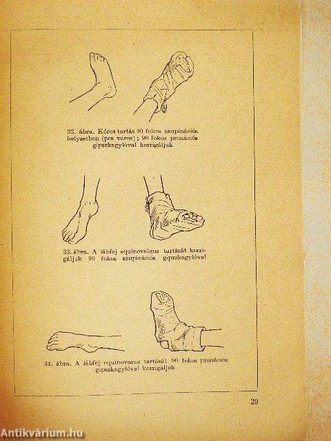 A Heine Medines mozgászavarok utókezelése