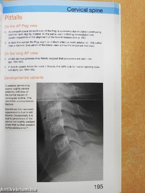 Accident & Emergency Radiology