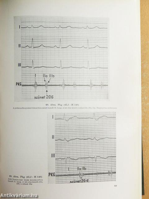 Klinikai és kísérleti elektrokardiographia