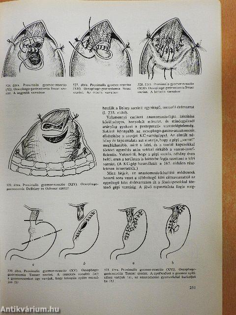 Sebészeti műtéttan