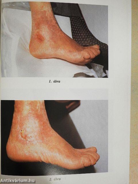 Természetgyógyászat dióhéjban