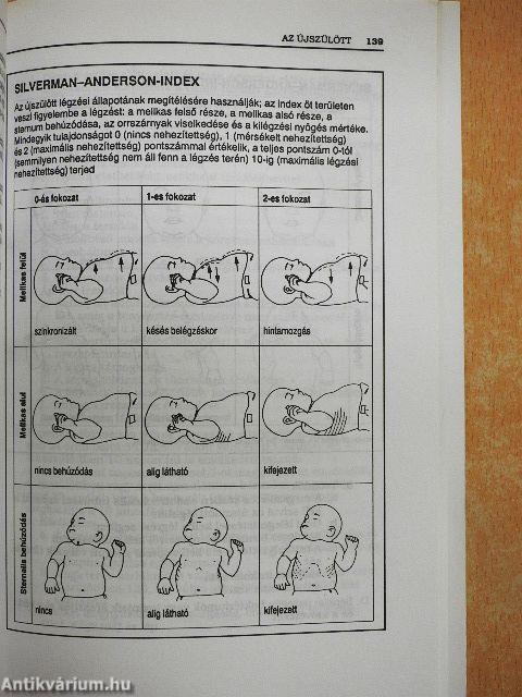 Szülészeti és újszülöttkori ápolás