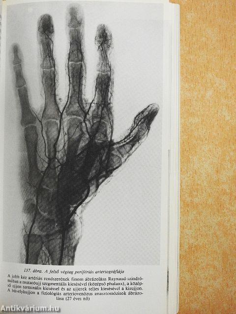 Artériás, vénás és nyirokér-megbetegedések diagnózisa