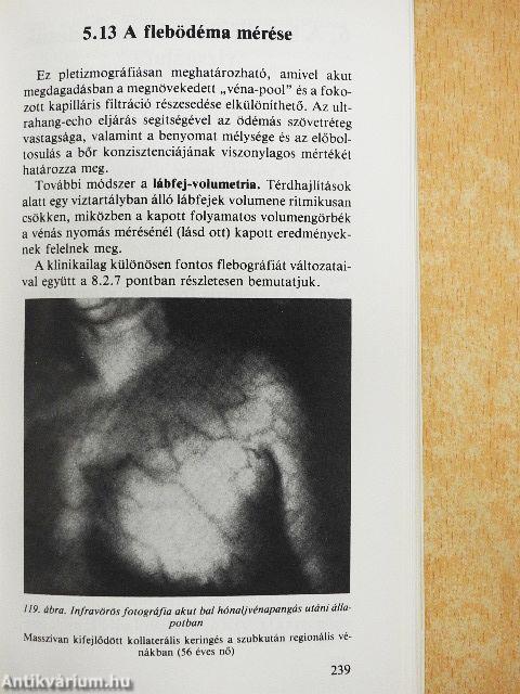 Artériás, vénás és nyirokér-megbetegedések diagnózisa