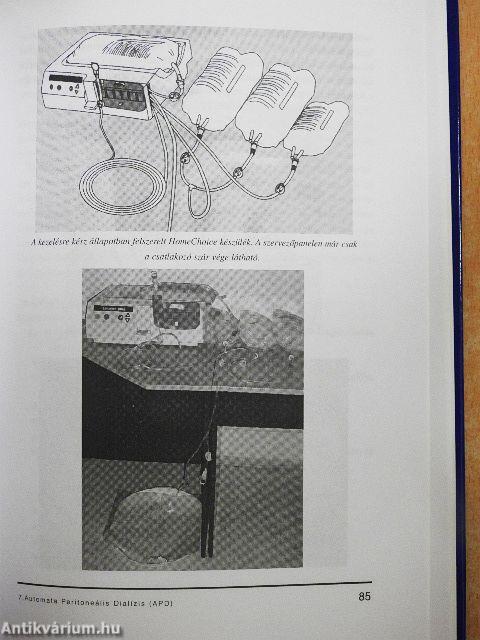 A CAPD tréning alapjai