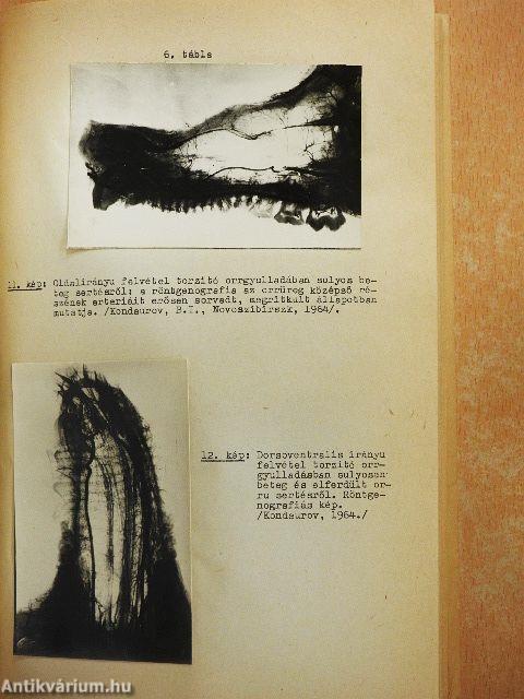 A sertés torzító orrgyulladása