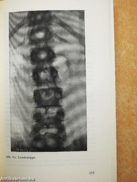 Schmerz bei Funktionsstörungen des Bewegungssystems