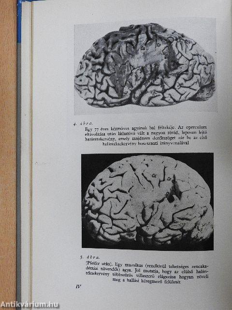 Zenei képesség-zenei készség