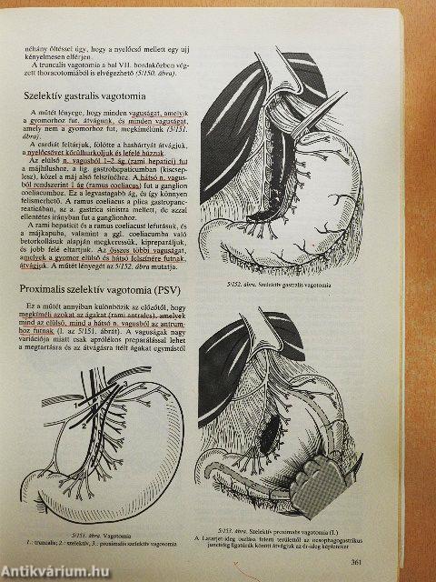 Sebészeti műtéttan
