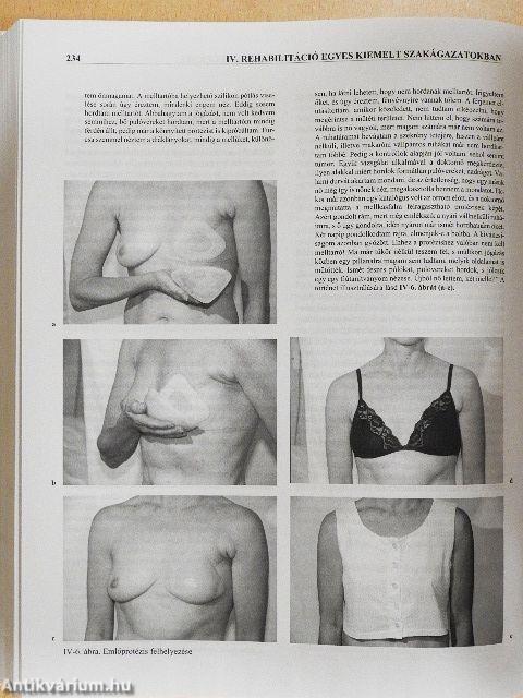 A rehabilitáció gyakorlata