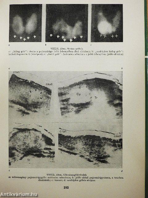 Radiológiai diagnosztika I-II.