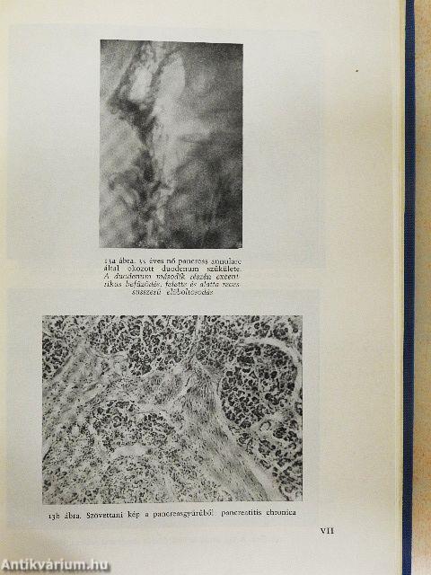 A leggyakoribb diagnosztikus tévedések