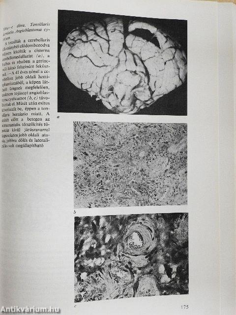 A klinikai neurologia alapjai
