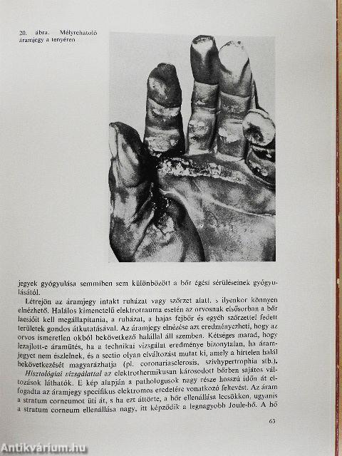 Az elektromos baleset és a villámcsapás klinikuma és pathologiája