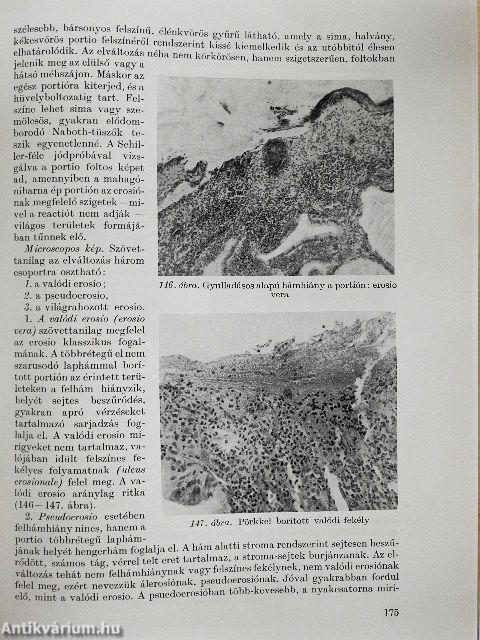Nőgyógyászati pathologia