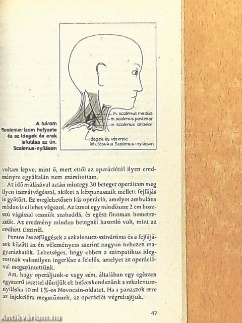 A migrének és a fejfájások gyógyíthatók