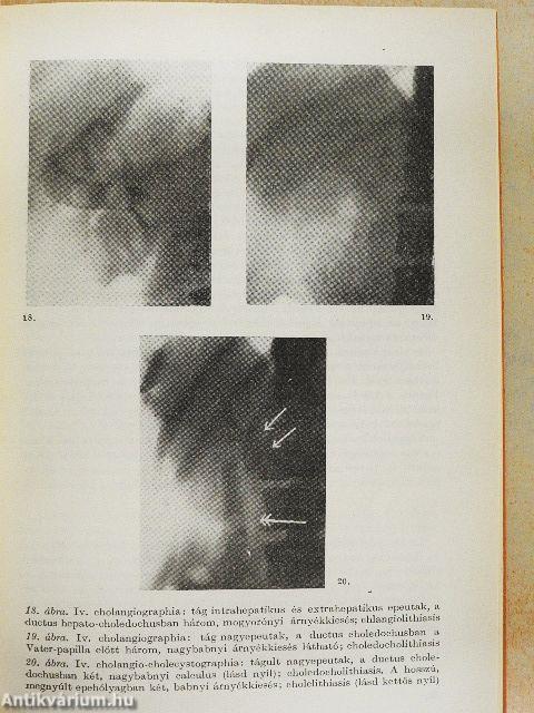 Az epehólyag és az epeutak betegségei