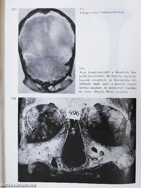 Az élet meghosszabbítható