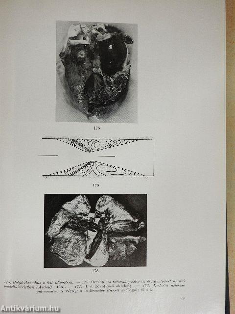 A kórbonctan elemei 1-3.