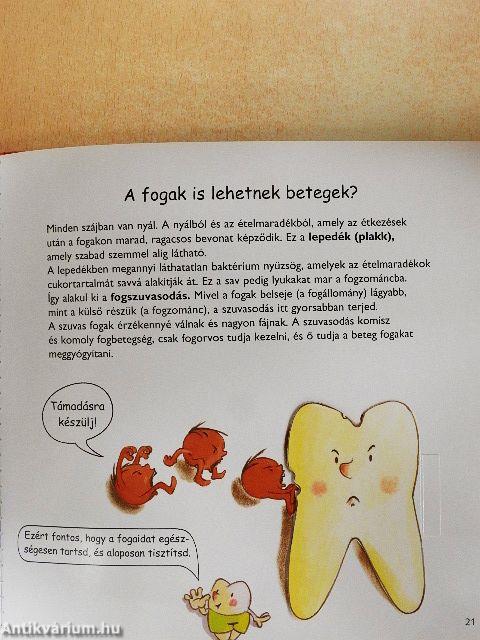 Izgő-mozgó fogaim