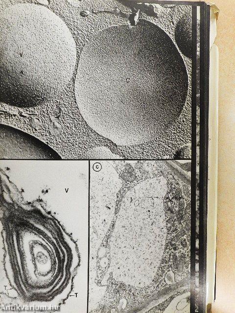 Ultrastructure and the Biology of Plant Cells