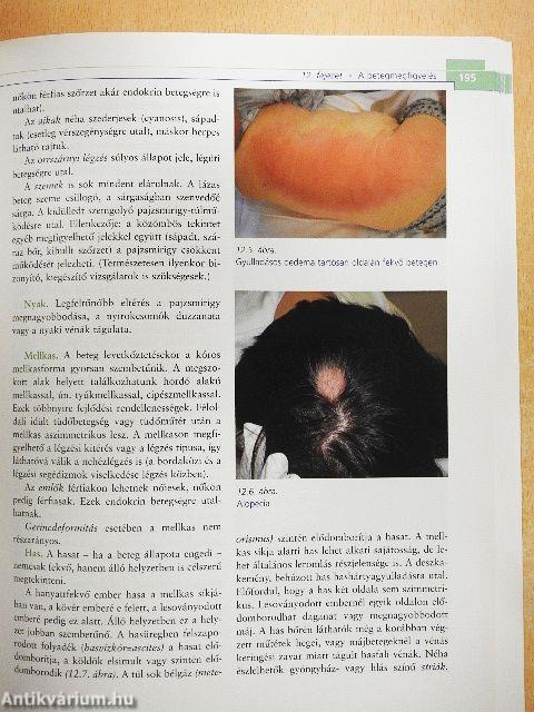 Általános ápolástan és gondozástan