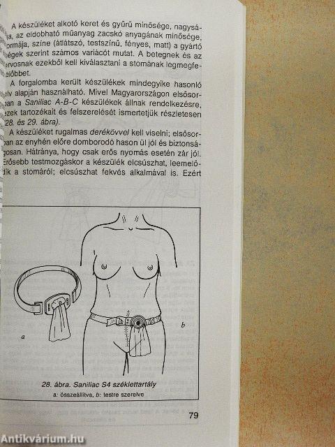 A hasi stomák korszerű ellátása