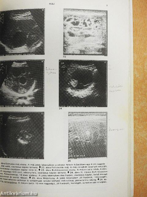 Ultrahang diagnosztika