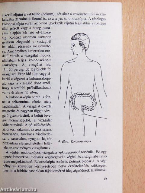 Amit a vastagbélgyulladásról tudni kell