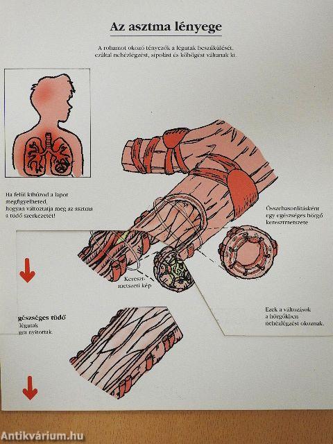 Az ASZTMÁRÓL gyerekeknek