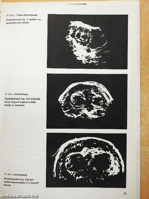 A kismedence és a has ultrahangvizsgálata