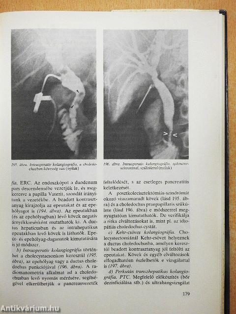 A radiológia alapfogalmai