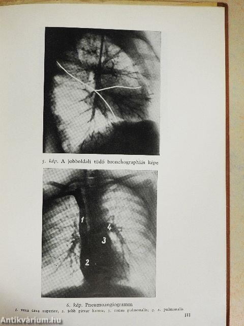 Nem-gümős tüdőbetegségek