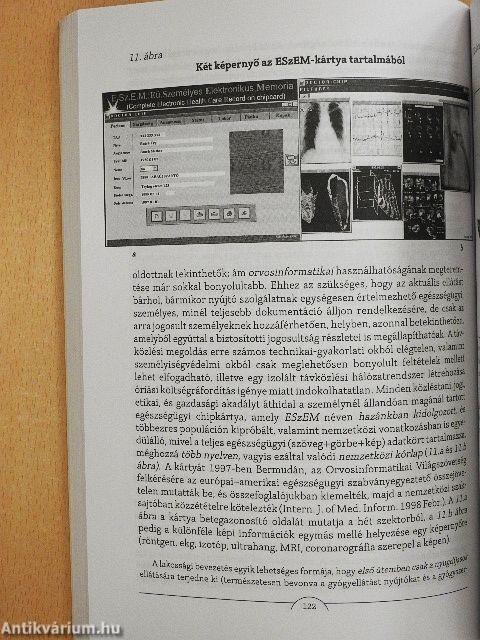 Civilizáció és egészség