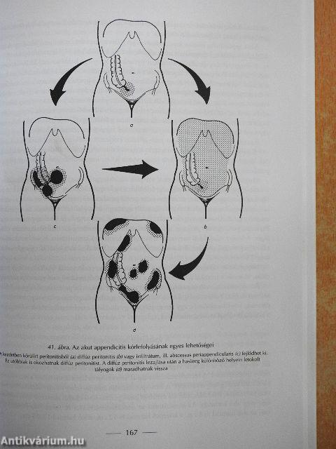 Klinikai ismeretek a sebészet köréből ápolónők részére