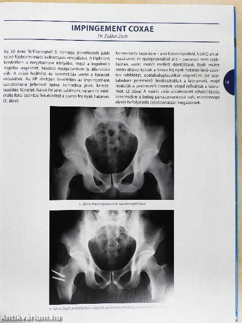 Stratégiai szempontok a mozgásszervi betegségek kezelésében